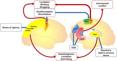 A Critical Review of Alien Limb-Related Phenomena and Implications for Functional Magnetic Resonance Imaging Studies